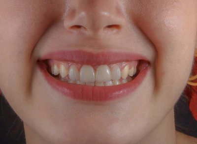 Dental Care